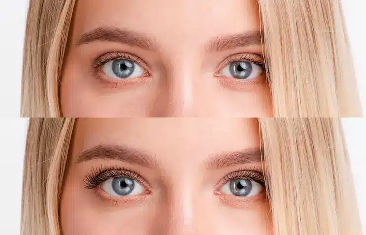 Lumi Eyes Before and After